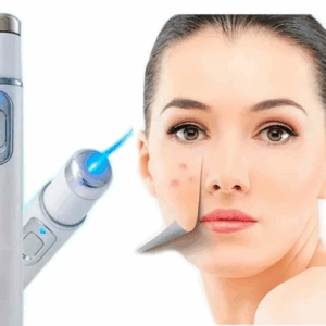 Lápiz Láser Masaje Luz Azul