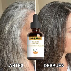 alt="serum anticanas tratamiento capilar" alt="serum anticanas nutrición para cabello" alt="tratamiento serum anticanas cabello fuerte" alt="serum anticanas para reducir canas prematuras" alt="serum anticanas aplicación diaria cabello"